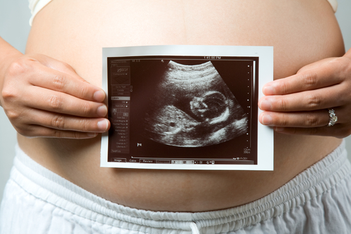 Ultralydsbillede foran gravid mave