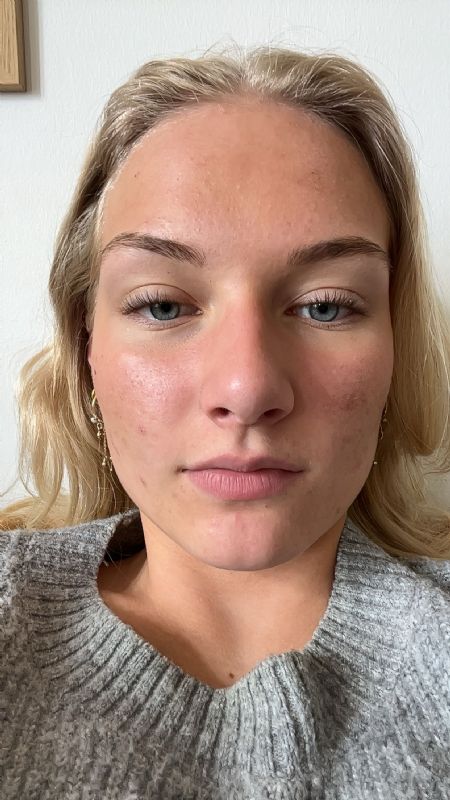 Profilbillede af Anna- ID: 1736372 - Billede nr: 619041