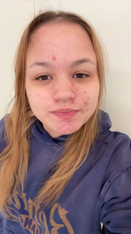 Billede af Tenna - ID: 1740387 - Billede nr: 668689